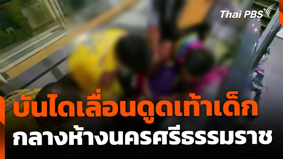 บันไดเลื่อนดูดเท้าเด็กอายุ 12 ปี กลางห้างเมืองนครศรีธรรมราช