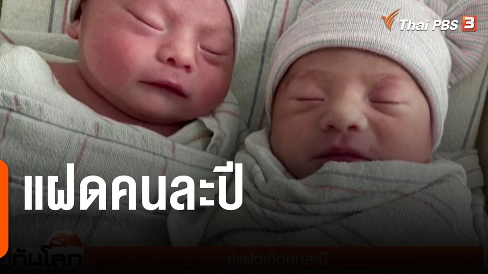 แฝดคนละปี