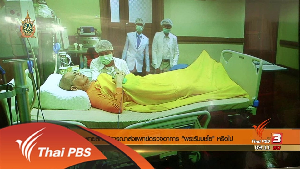 ประเด็นข่าว (2 มิ.ย. 59)