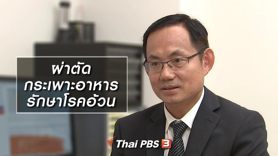 ผ่าตัดกระเพาะอาหาร รักษาโรคอ้วน