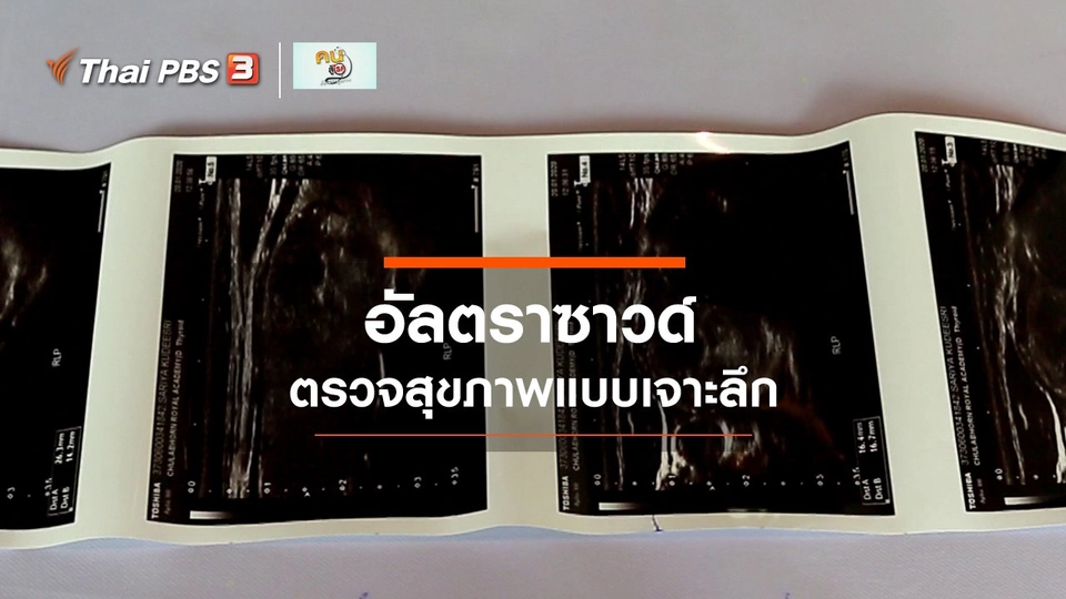 ​รู้สู้โรค : อัลตราซาวด์ ตรวจสุขภาพแบบเจาะลึก
