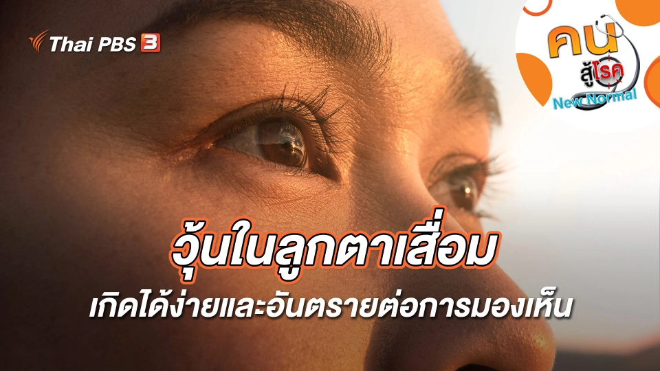 วุ้นในลูกตาเสื่อม เกิดได้ง่ายและอันตรายต่อการมองเห็น