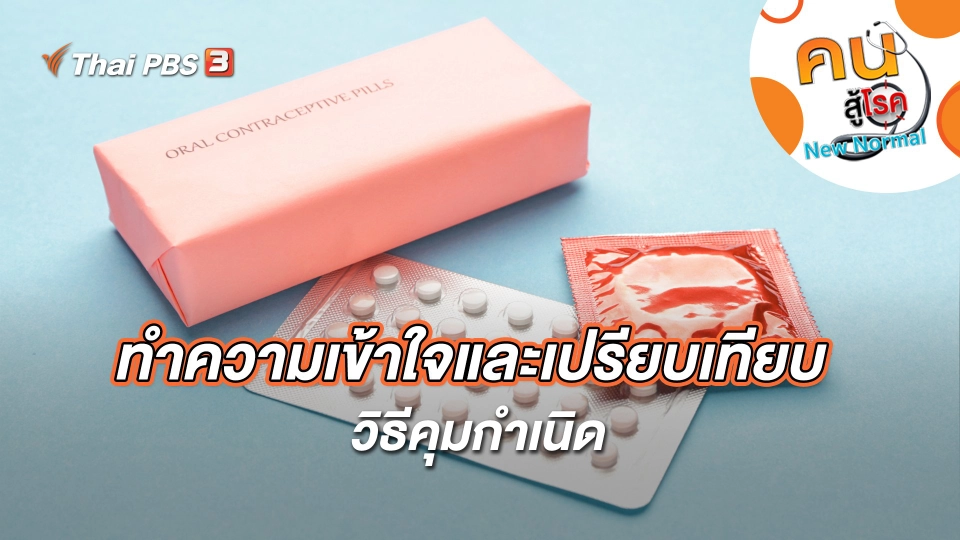 ทำความเข้าใจและเปรียบเทียบวิธีคุมกำเนิด