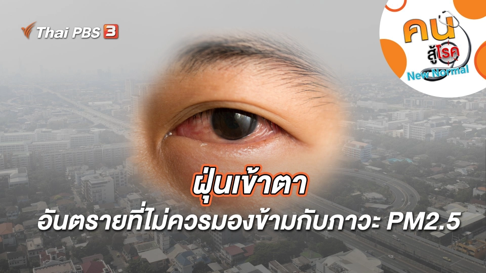 ฝุ่นเข้าตาอันตรายที่ไม่ควรมองข้ามกับภาวะ PM2.5