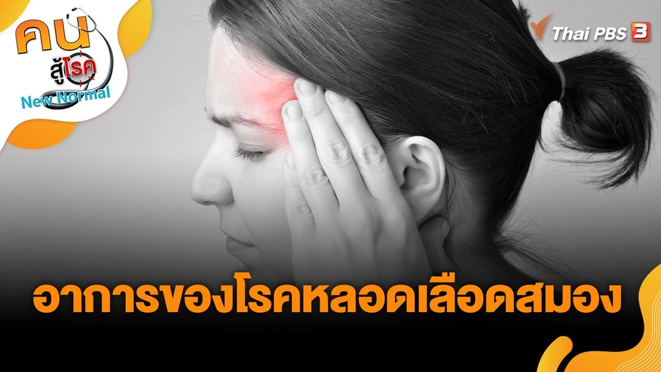 อาการของโรคหลอดเลือดสมอง