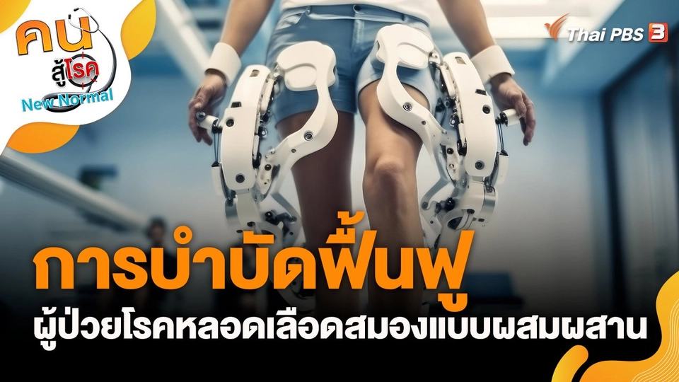 การบำบัดฟื้นฟูผู้ป่วยโรคหลอดเลือดสมองแบบผสมผสาน