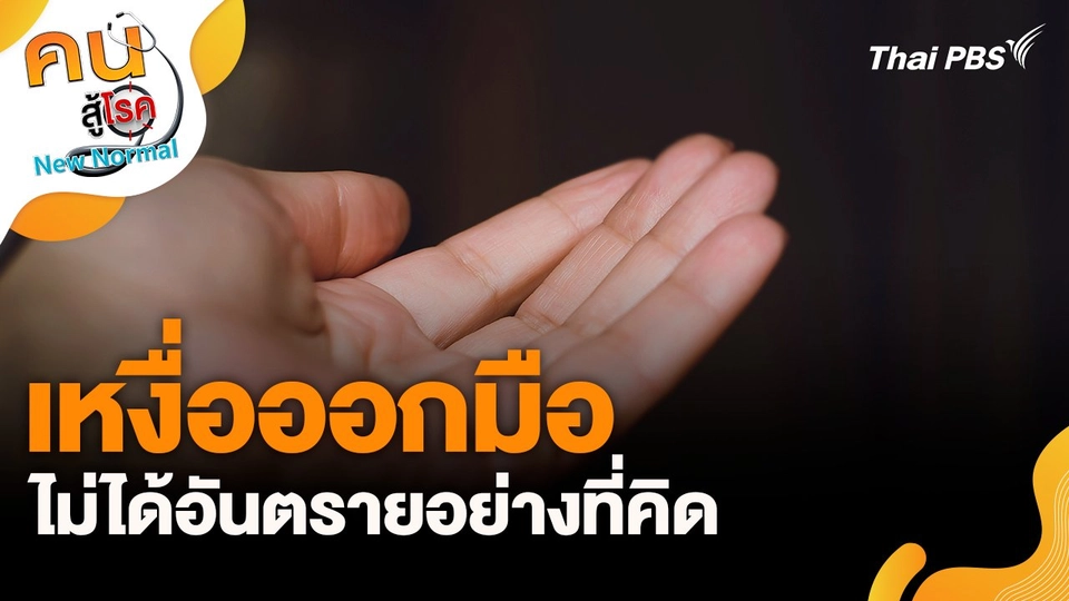 เหงื่อออกมือ