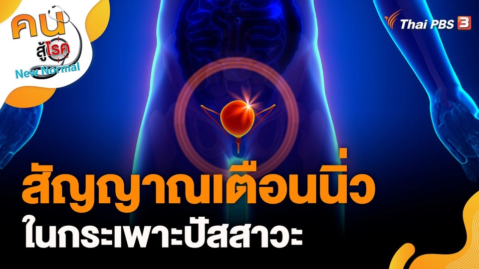 สัญญาณเตือนนิ่วในกระเพาะปัสสาวะ