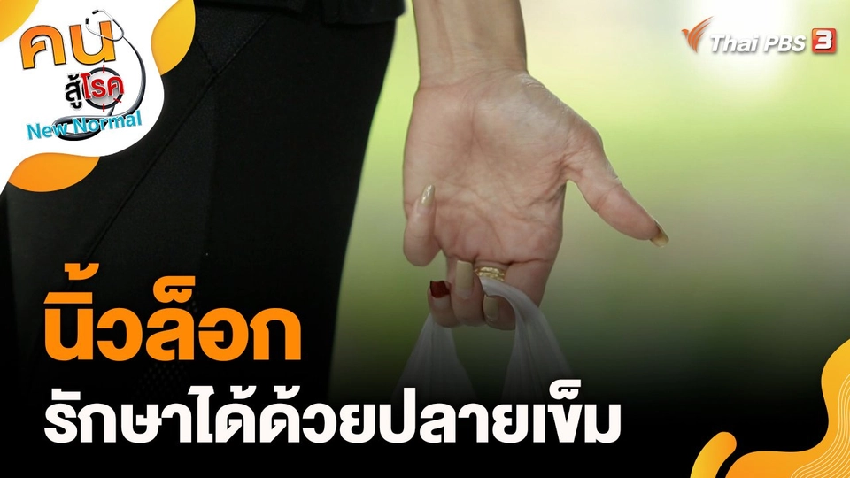 นิ้วล็อก รักษาได้ด้วยปลายเข็ม