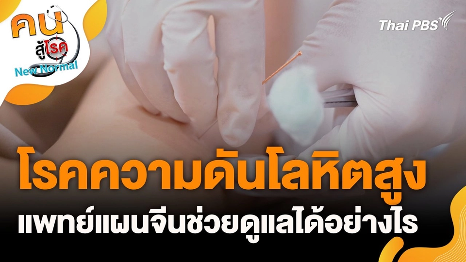 โรคความดันโลหิตสูง แพทย์แผนจีนช่วยดูแลได้อย่างไร