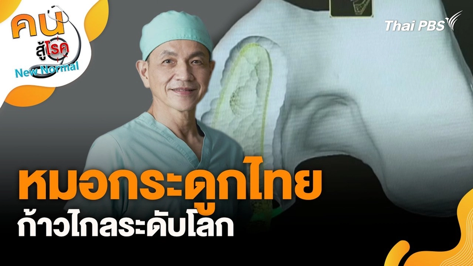 หมอกระดูกไทยก้าวไกลระดับโลก