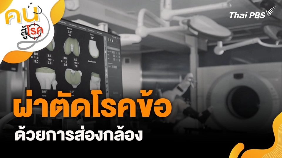 ผ่าตัดโรคข้อด้วยการส่องกล้อง