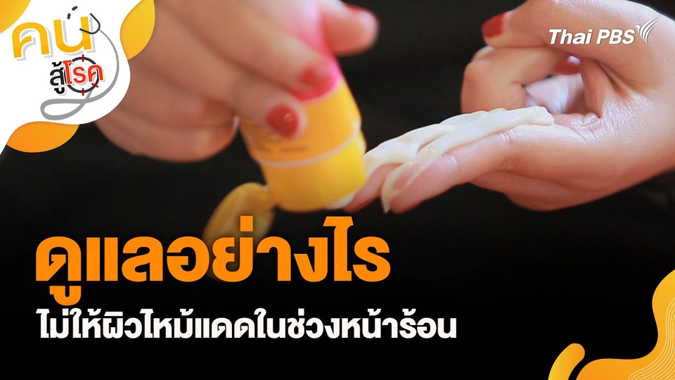 ดูแลอย่างไรไม่ให้ผิวไหม้แดดในช่วงหน้าร้อน