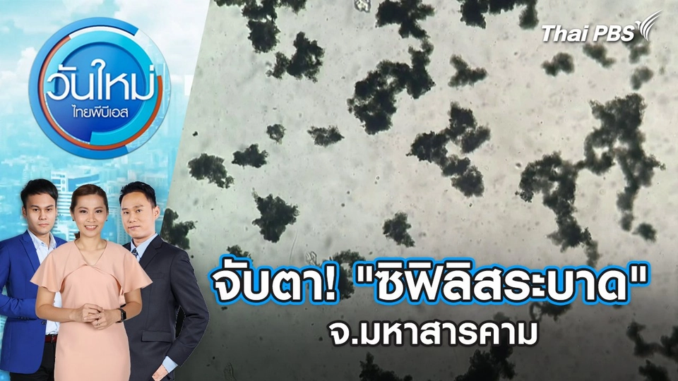 จับตา! "ซิฟิลิสระบาด" จ.มหาสารคาม | 29 พ.ค. 68