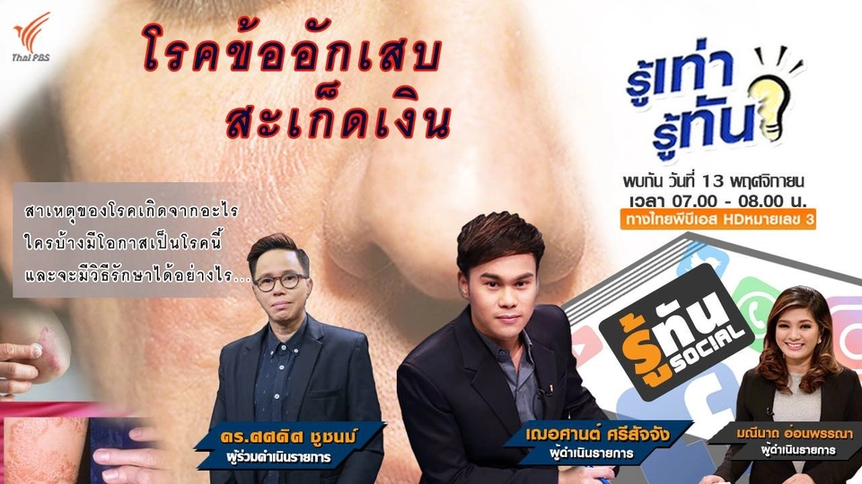 โรคข้ออักเสบสะเก็ดเงิน