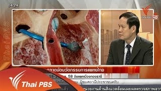 ตลาดนัดนวัตกรรมการแพทย์ไทย