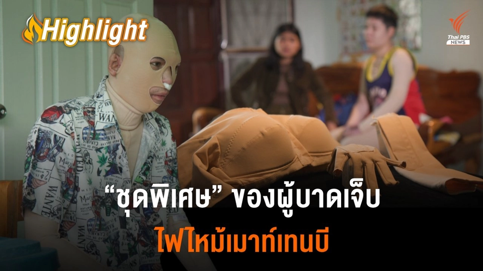 ชีวิตผู้บาดเจ็บ​เหตุเมาท์เทนบี กับ "ชุดพิเศษ" ที่ต้องใส่ 24 ชม.