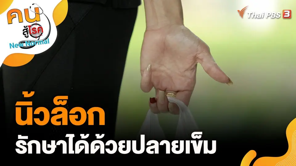 นิ้วล็อก รักษาได้ด้วยปลายเข็ม