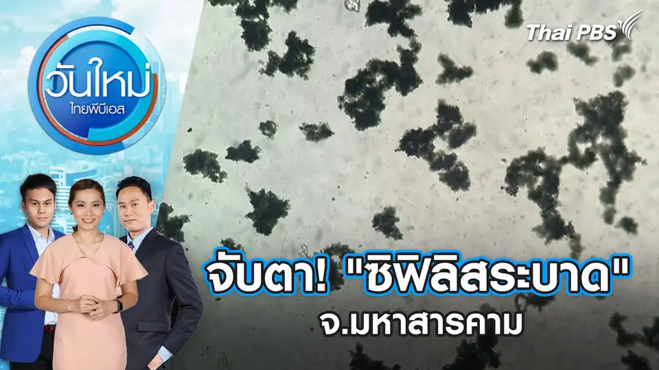 จับตา! "ซิฟิลิสระบาด" จ.มหาสารคาม | 29 พ.ค. 68