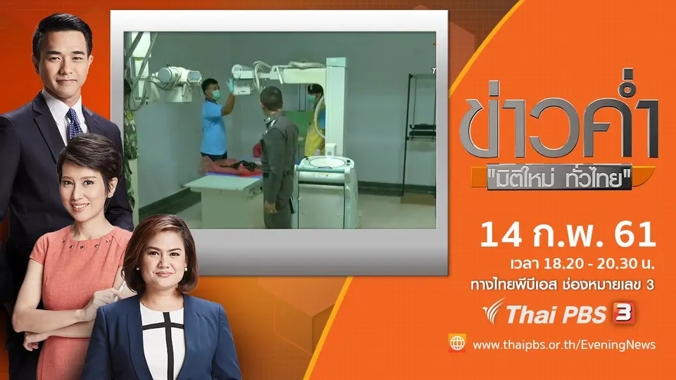 ประเด็นข่าว ( 14 ก.พ. 61)