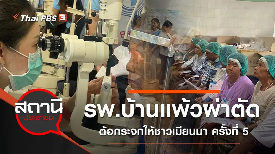รพ.บ้านแพ้วผ่าตัดต้อกระจกให้ชาวเมียนมา ครั้งที่ 5