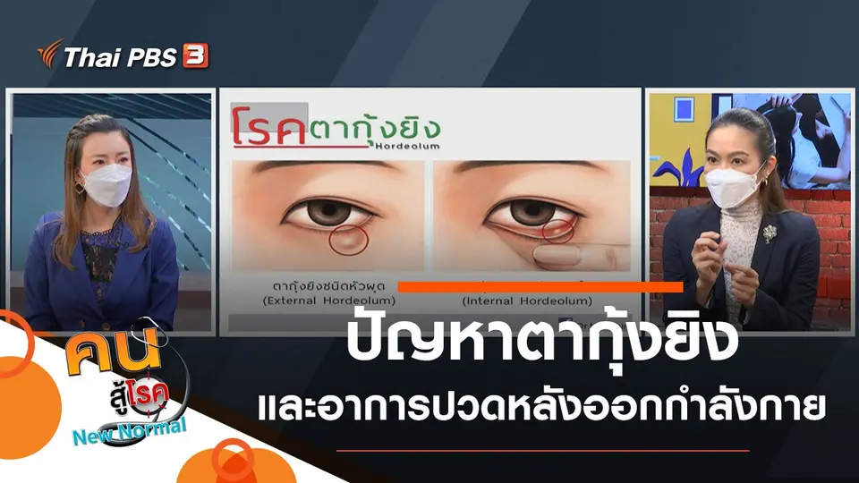 ปัญหาตากุ้งยิง, อาการปวดกล้ามเนื้อหลังออกกำลังกาย