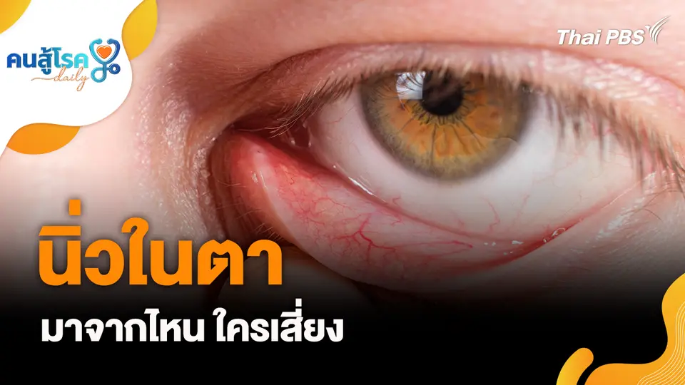 คนสู้โรค