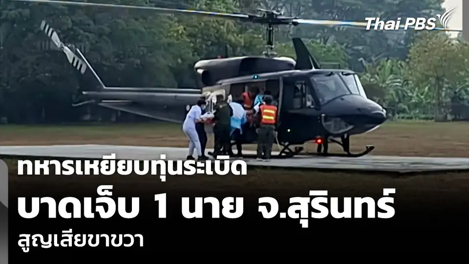 ทหารเหยียบทุ่นระเบิด จ.สุรินทร์ บาดเจ็บ 1 นาย สูญเสียขาขวา