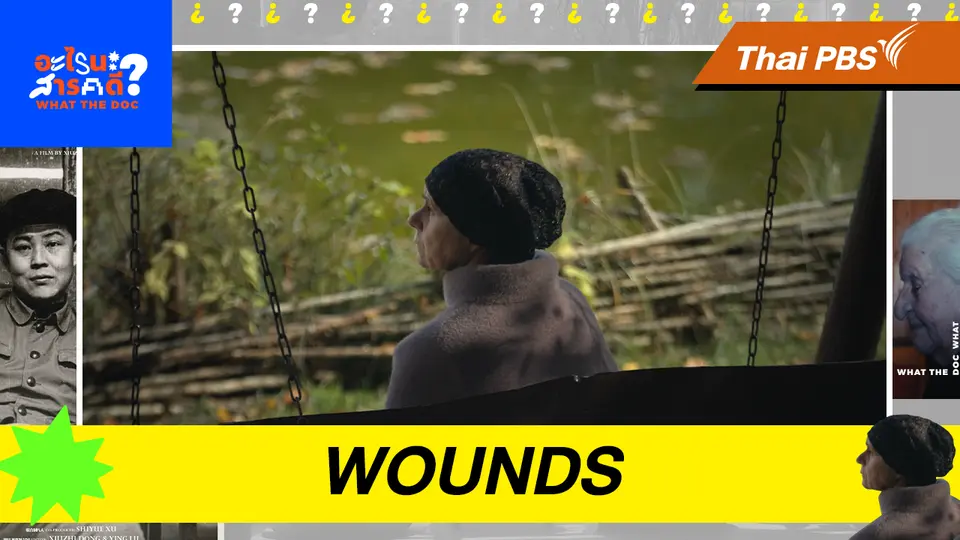 Wounds