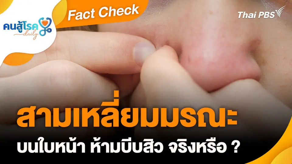 Fact Check : "สามเหลี่ยมมรณะ" บนใบหน้า ห้ามบีบสิว จริงหรือ ?