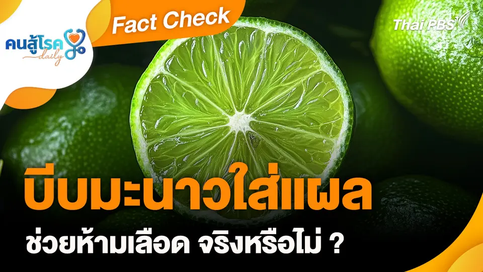 Fact Check : บีบมะนาวใส่แผล ช่วยห้ามเลือด จริงหรือไม่ ?