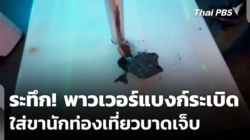ระทึก! พาวเวอร์แบงก์ระเบิด ใส่ขานักท่องเที่ยวบาดเจ็บ