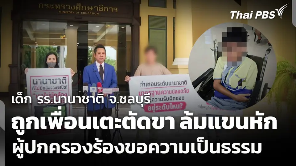 เด็ก รร.นานาชาติ จ.ชลบุรี ถูกเพื่อนเตะตัดขา ล้มแขนหัก