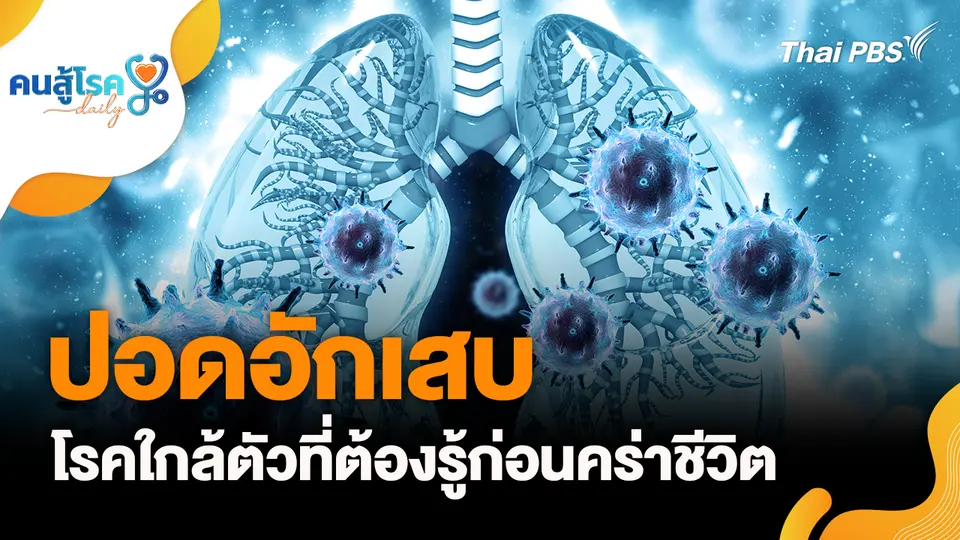 "ปอดอักเสบ" โรคใกล้ตัวที่ต้องรู้, ควันบุหรี่ไฟฟ้า คือ "ไอน้ำ" ไม่อันตราย จริงหรือ ?