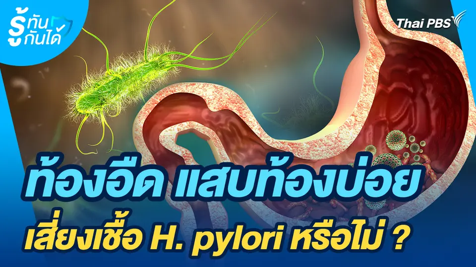 รู้ทันกันได้ : ท้องอืด แสบท้องบ่อย เสี่ยงเชื้อ H. pylori หรือไม่ ?