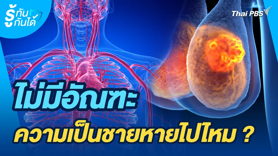 รู้ทันกันได้ : ไม่มีอัณฑะ ความเป็นชายหายไปไหม ?