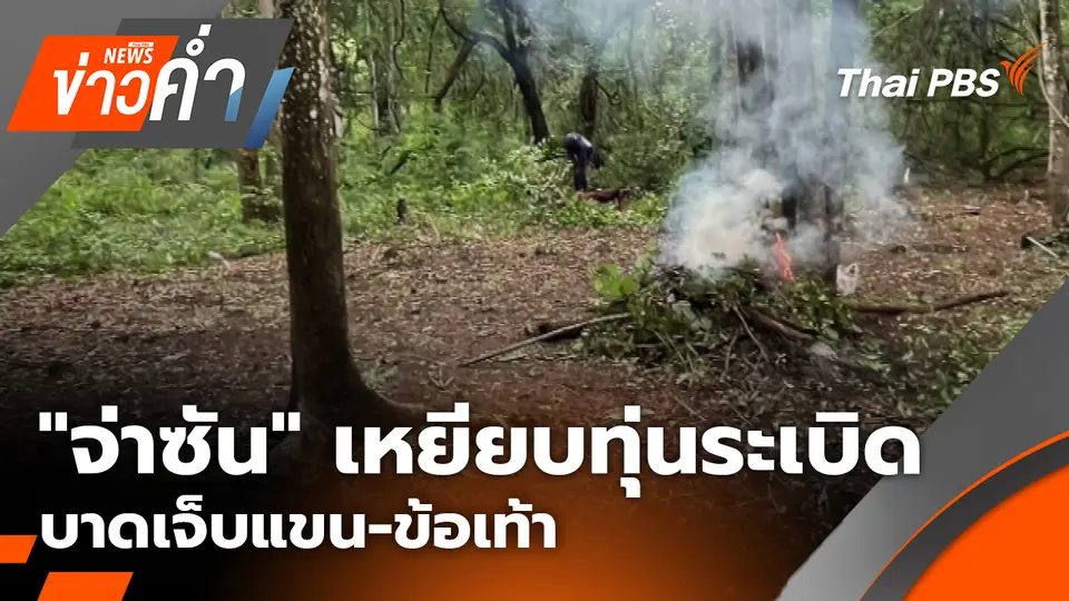 "จ่าซัน" เหยียบทุ่นระเบิด บาดเจ็บแขน-ข้อเท้า