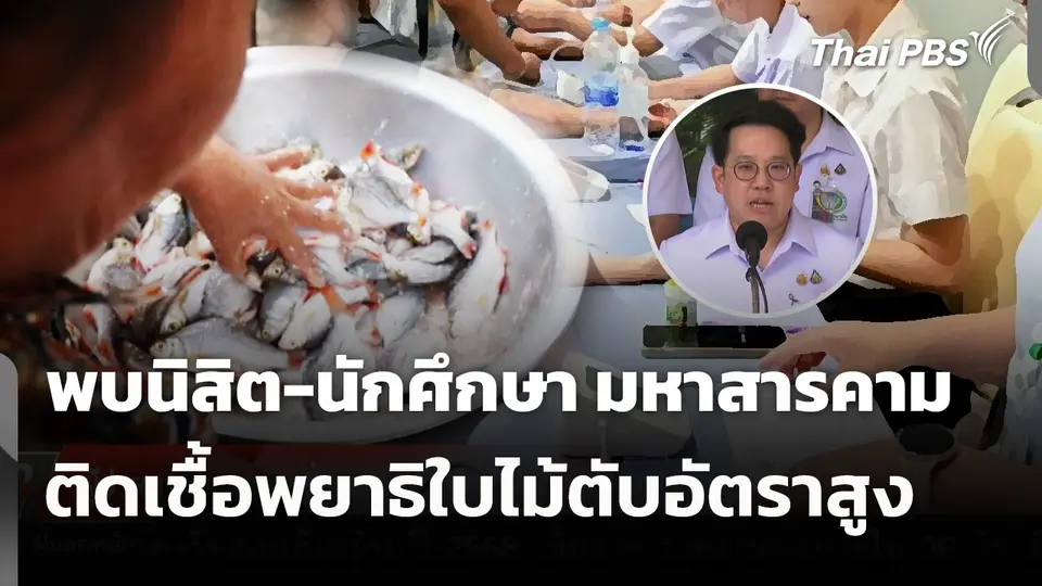 พบนิสิต-นักศึกษา มหาสารคาม ติดเชื้อพยาธิใบไม้ตับอัตราสูง 