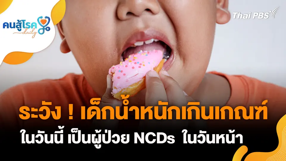ระวัง ! เด็กน้ำหนักเกินเกณฑ์ในวันนี้ เป็นผู้ป่วย NCDs  ในวันหน้า