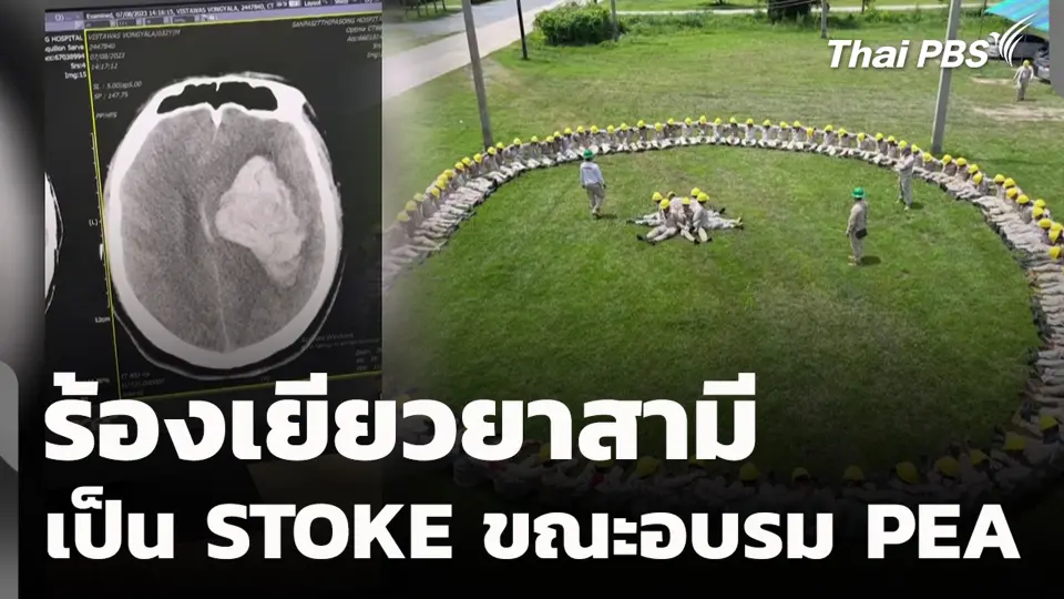 ร้องเยียวยาสามี เป็น STOKE ขณะอบรม PEA