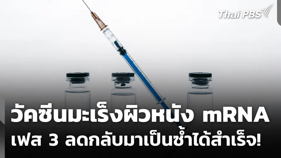 วัคซีนมะเร็งผิวหนัง mRNA เฟส 3 ลดกลับมาเป็นซ้ำได้สำเร็จ