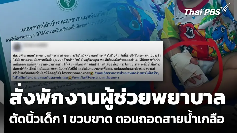 สสจ.ยโสธร สั่งพักงานผู้ช่วยพยาบาล ตัดนิ้วเด็ก 1 ขวบขาด ตอนถอดสายน้ำเกลือ