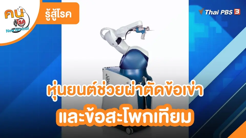 รู้สู้โรค : หุ่นยนต์ช่วยผ่าตัดข้อเข่าและข้อสะโพกเทียม