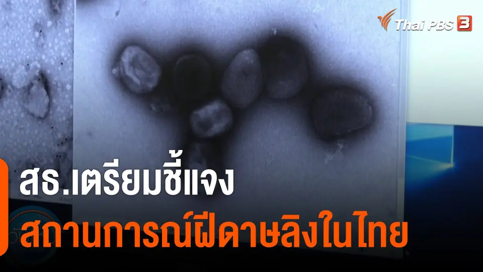 สธ.เตรียมชี้แจงสถานการณ์ฝีดาษลิงในไทย