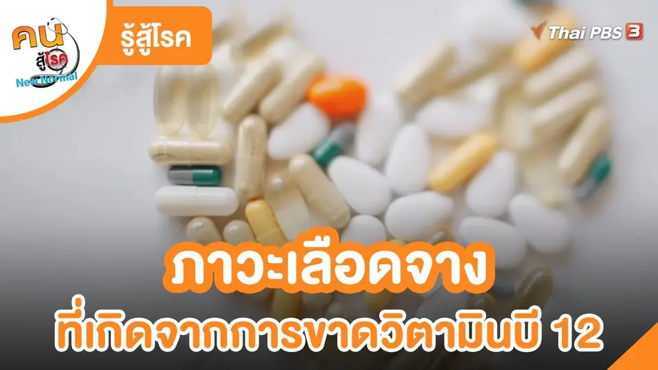 รู้สู้โรค : ภาวะเลือดจาง ที่เกิดจากการขาดวิตามินบี 12
