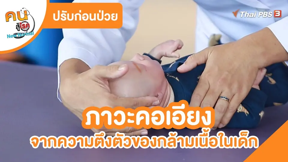 ​ปรับก่อนป่วย : ภาวะคอเอียงจากความตึงตัวของกล้ามเนื้อในเด็ก