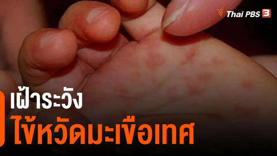 ​เฝ้าระวังไข้หวัดมะเขือเทศ