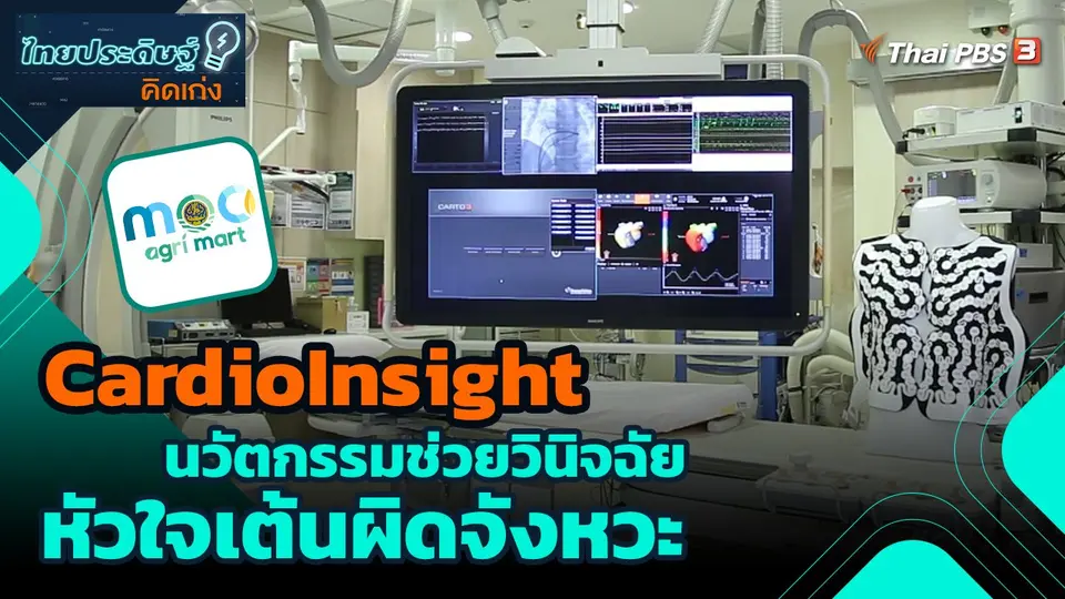 ​ไทยประดิษฐ์คิดเก่ง : CardioInsight นวัตกรรมช่วยวินิจฉัยหัวใจเต้นผิดจังหวะ