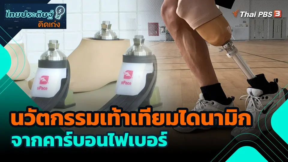 นวัตกรรมเท้าเทียมไดนามิกจากคาร์บอนไฟเบอร์