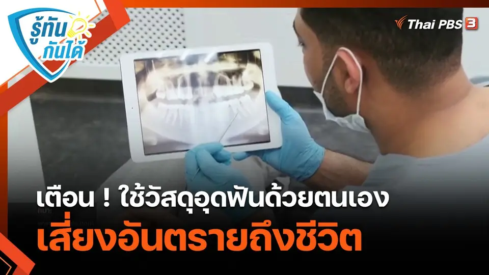 รู้ทันกันได้ : เตือน ! ใช้วัสดุอุดฟันด้วยตนเอง เสี่ยงอันตรายถึงชีวิต